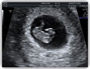 first dating ultrasound canada